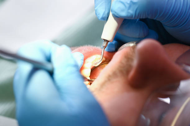 Best Emergency Treatment for Oral Infections in Masury, OH